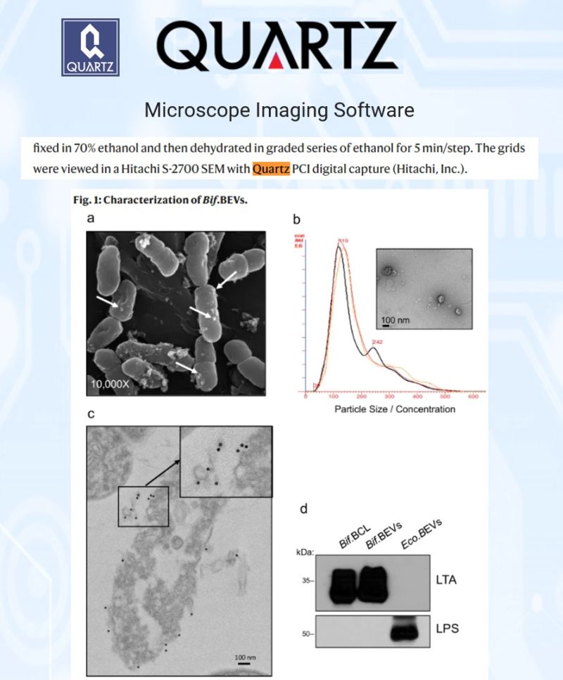 Spatial profiling of PD-L1 expression in lung tumor tissue, image analysis supported by Quartz PCI