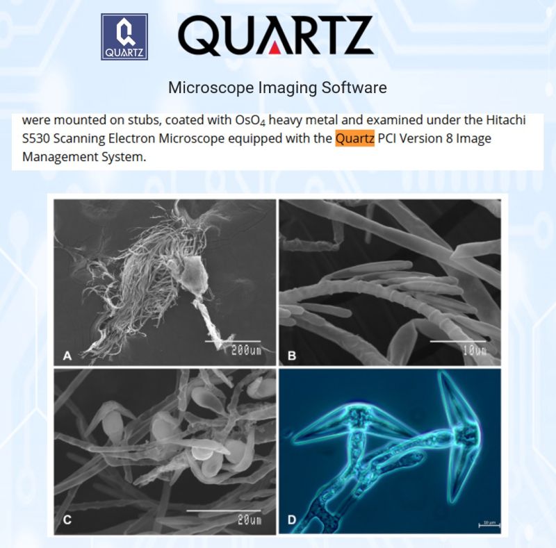 SEM micrographs of Ejectosporus trisporus, a stonefly gut fungal symbiont, captured with Quartz PCI