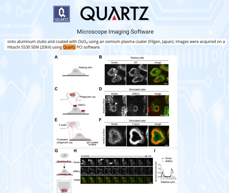 SEM micrograph of macrophage phagocytosis surface from a Hitachi S530, captured with Quartz PCI